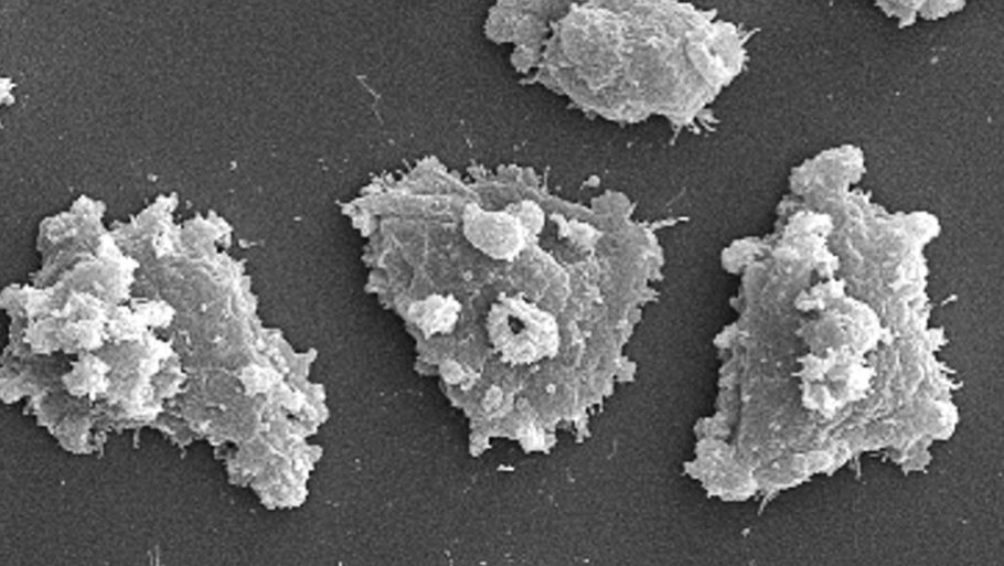 50 years ago, scientists were on the trail of a brain-eating amoeba